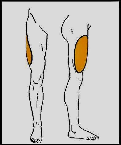 Clinical Presentation